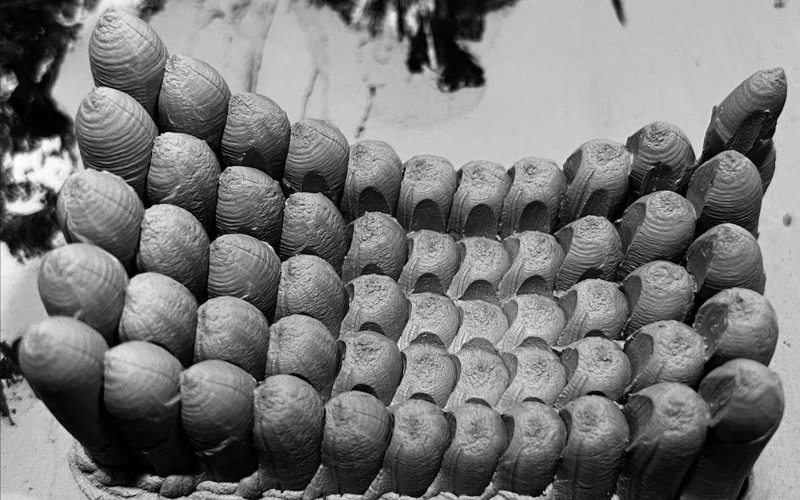 Microneedle project image MN4