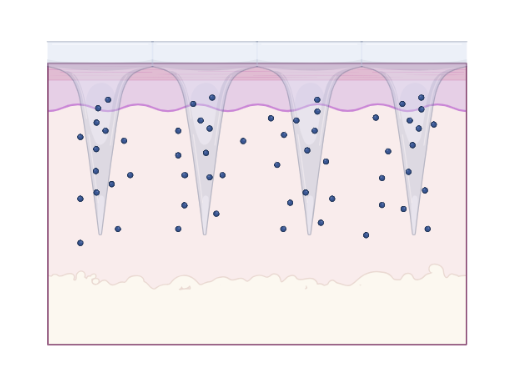 Microneedle project image MN4